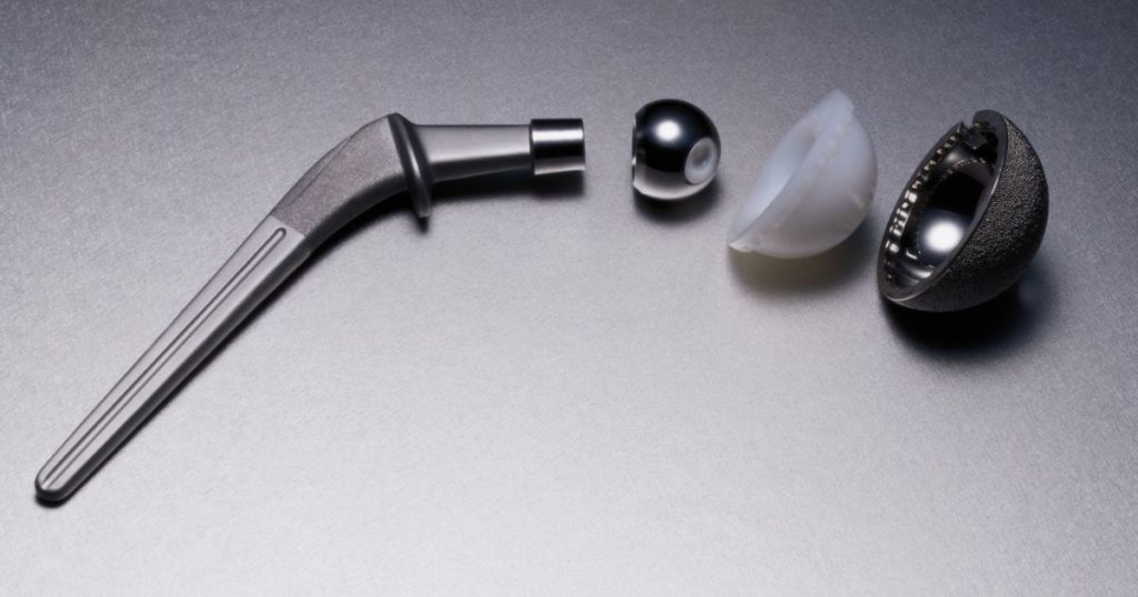 What Are Signs My Hip Replacement Is Defective?